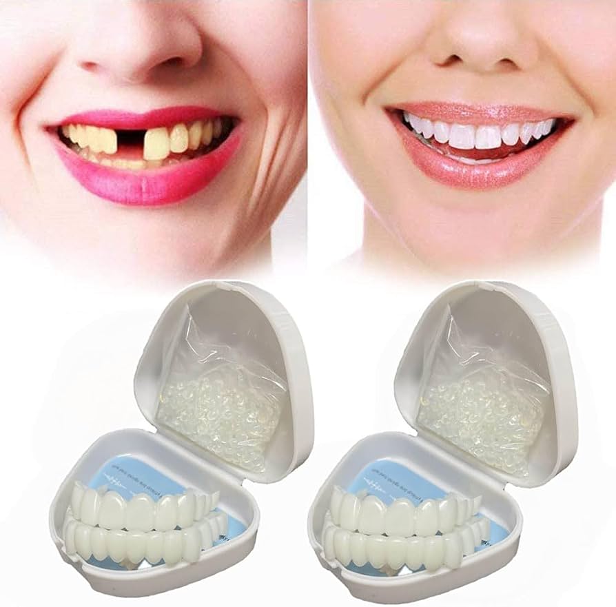 Removable Dental Veneers – Instant Smile & Natural-Looking Teeth Cover