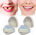 Removable Dental Veneers – Instant Smile & Natural-Looking Teeth Cover